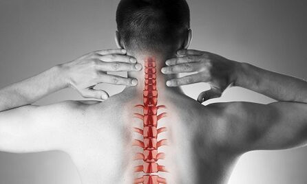 Kako se očituje osteohondroza kralježnice grlića maternice