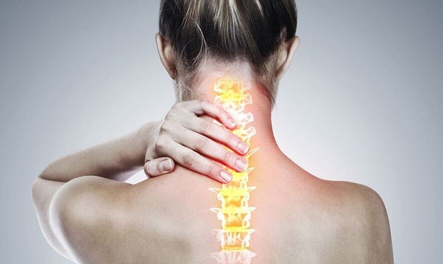 Osteokondroza vratne kralježnice